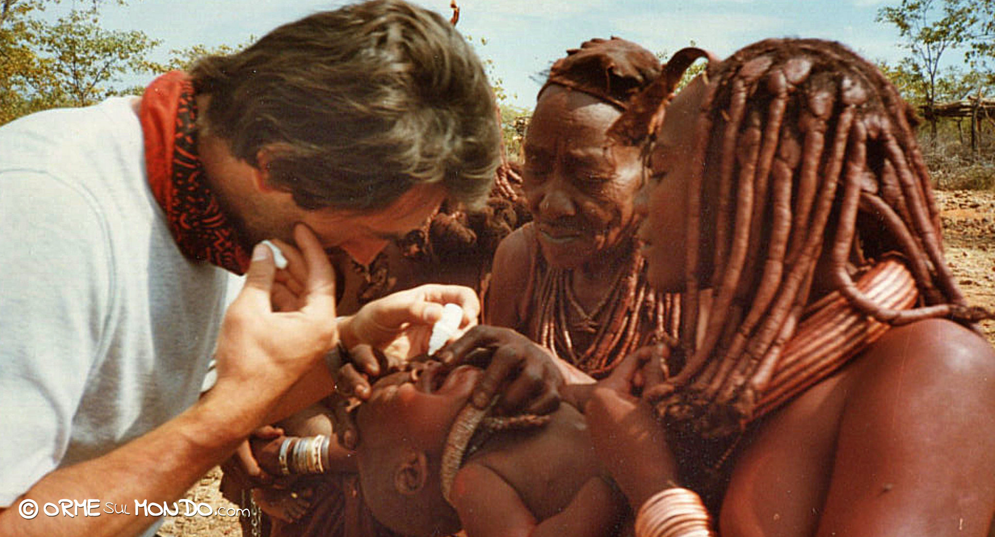 Un collirio per lenire l'irritazione agli occhi di un piccolo Himba